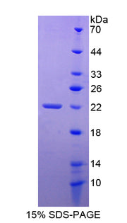 Figure 1. SDS-PAGE