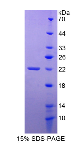 Figure 1. SDS-PAGE