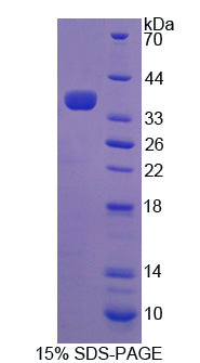 Figure 1. SDS-PAGE