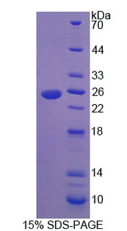 Figure 1. SDS-PAGE
