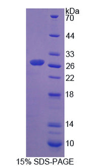 Figure 1. SDS-PAGE