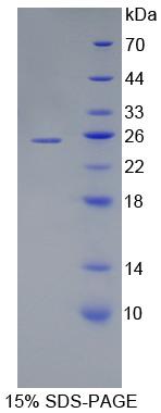 Figure 1. SDS-PAGE