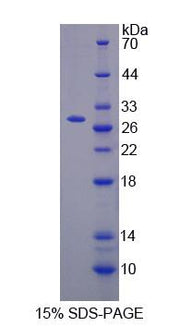 Figure 1. SDS-PAGE