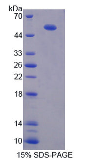 Figure 1. SDS-PAGE