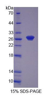 Figure 1. SDS-PAGE