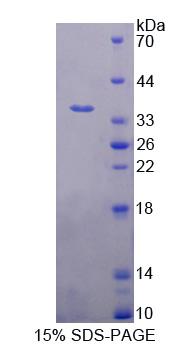 Figure 1. SDS-PAGE