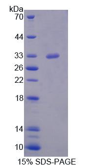 Figure 1. SDS-PAGE