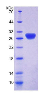 Figure 1. SDS-PAGE