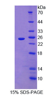 Figure 1. SDS-PAGE
