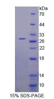 Figure 1. SDS-PAGE