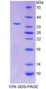 Figure 1. SDS-PAGE