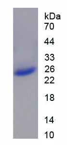 Figure 1. SDS-PAGE
