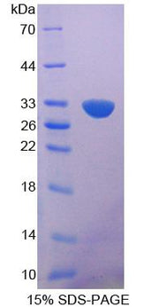 Figure 1. SDS-PAGE