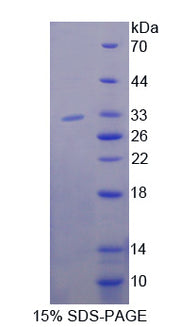 Figure 1. SDS-PAGE