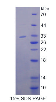 Figure 1. SDS-PAGE