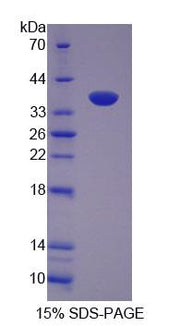 Figure 1. SDS-PAGE