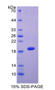 Figure 1. SDS-PAGE
