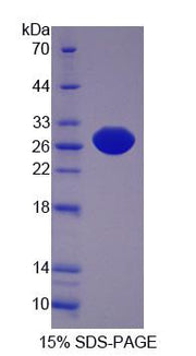 Figure 1. SDS-PAGE