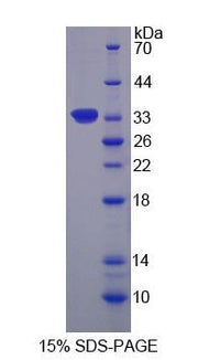 Figure 1. SDS-PAGE