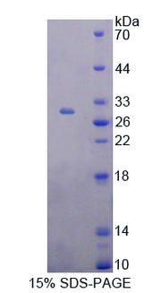 Figure 1. SDS-PAGE