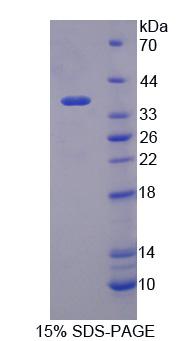 Figure 1. SDS-PAGE
