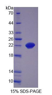 Figure 1. SDS-PAGE