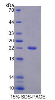 Figure 1. SDS-PAGE