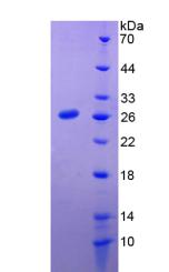 Figure 2. SDS-PAGE