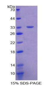 Figure 1. SDS-PAGE