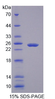 Figure 1. SDS-PAGE