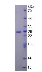 Figure 2. SDS-PAGE
