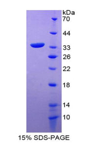 Figure 1. SDS-PAGE
