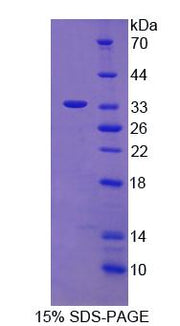 Figure 1. SDS-PAGE