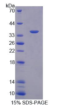 Figure 1. SDS-PAGE
