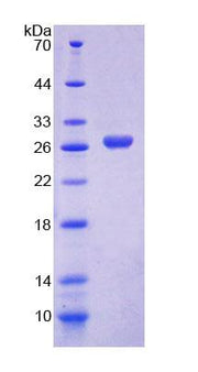 Figure 1. SDS-PAGE