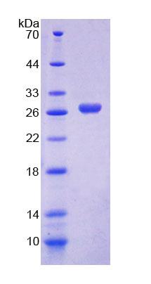 Figure 1. SDS-PAGE