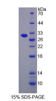 Figure 1. SDS-PAGE