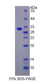 Figure 1. SDS-PAGE