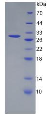 Figure 2. SDS-PAGE