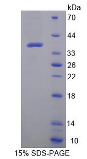 Figure 1. SDS-PAGE