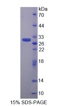 Figure 1. SDS-PAGE