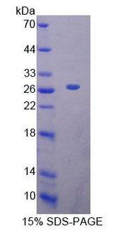 Figure 1. SDS-PAGE