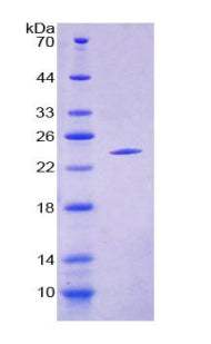Figure 1. SDS-PAGE