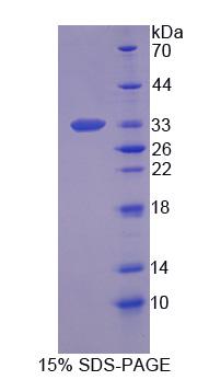 Figure 1. SDS-PAGE
