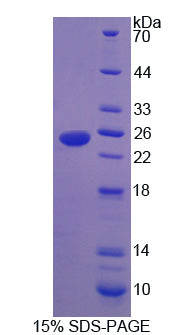 Figure 1. SDS-PAGE