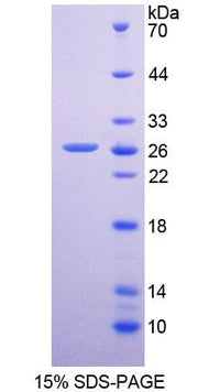 Figure 1. SDS-PAGE