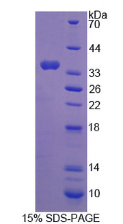 Figure 1. SDS-PAGE