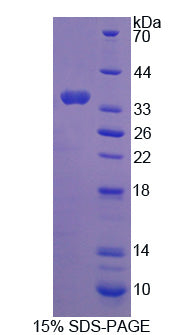 Figure 1. SDS-PAGE