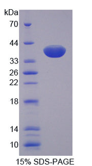 Figure 1. SDS-PAGE