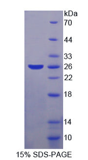 Figure 1. SDS-PAGE